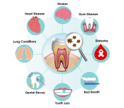 Dental-health Dental Health