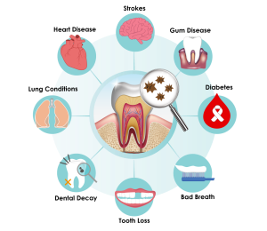 Ignoring your dental health can impact your overall health 