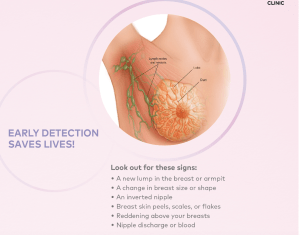 Early Detection Signs for Breast Cancer