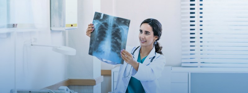 Chest General X Rays in Dubai
