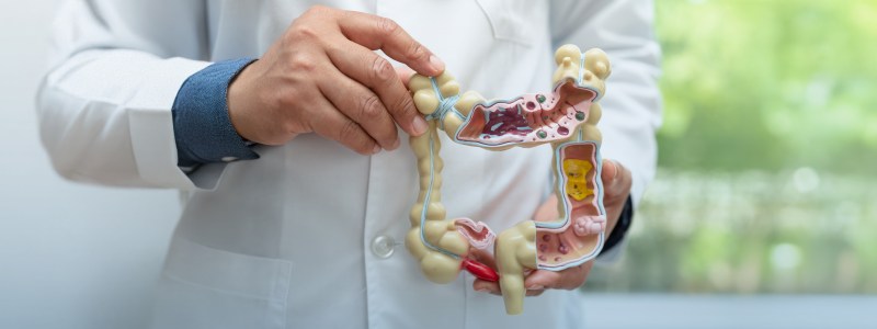 Irritable Bowel Syndrome (IBS)