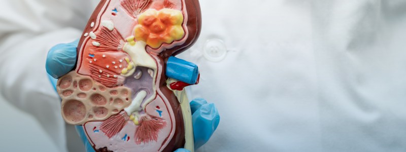 Kidney and Bladder cancers-01