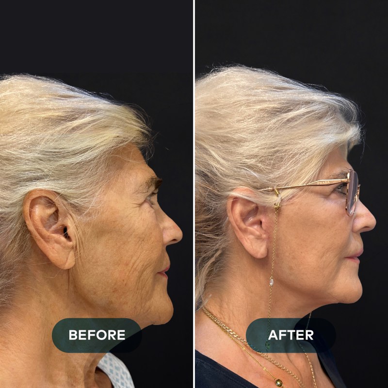 Plastic Surgeon New case-01