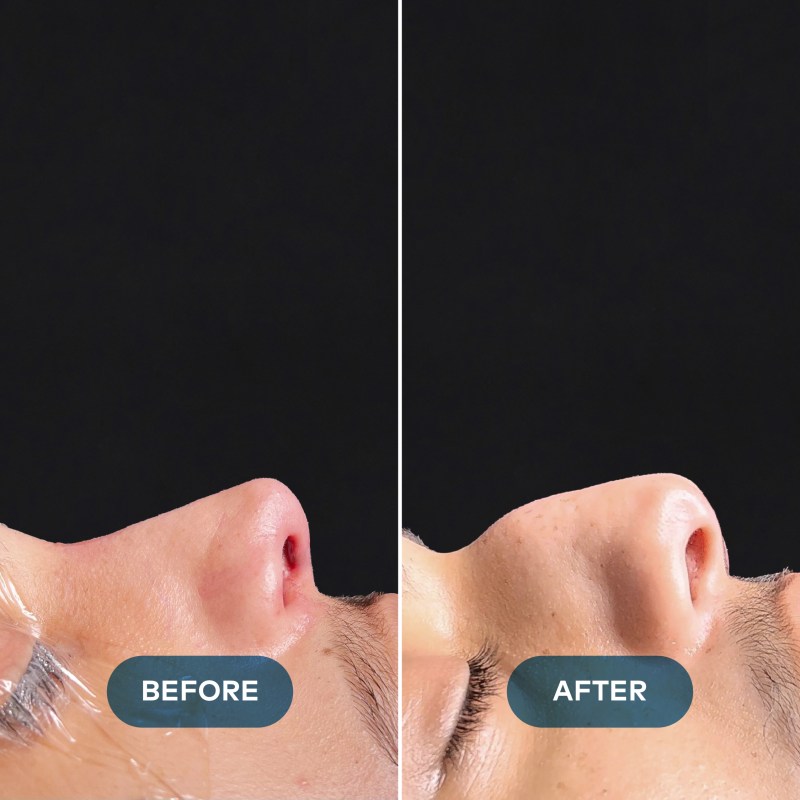 Plastic Surgeon New case-04