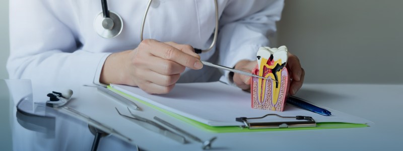 Root canal treatments