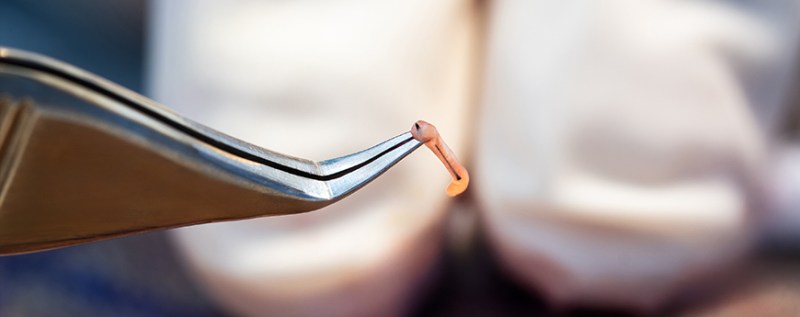 870X345-EXTRACTION_02