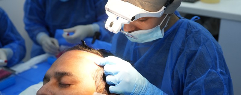 Long Hair Transplant