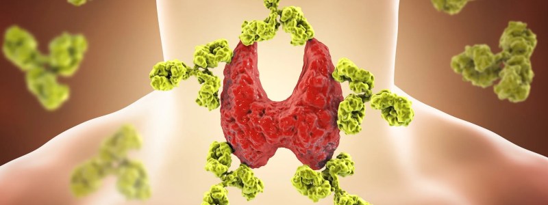 Ultrasound Thyroid treatment
