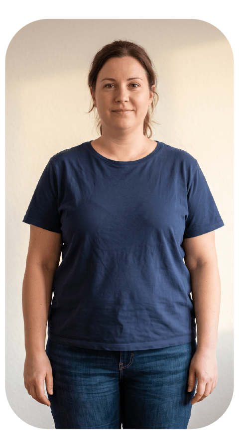 Patient 1 weight loss before