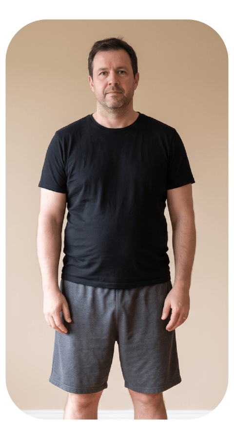 Patient 2 weight loss before
