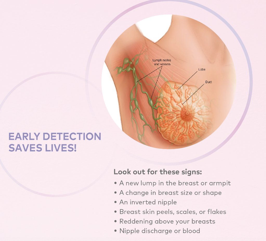 Early Detection Signs for Breast Cancer