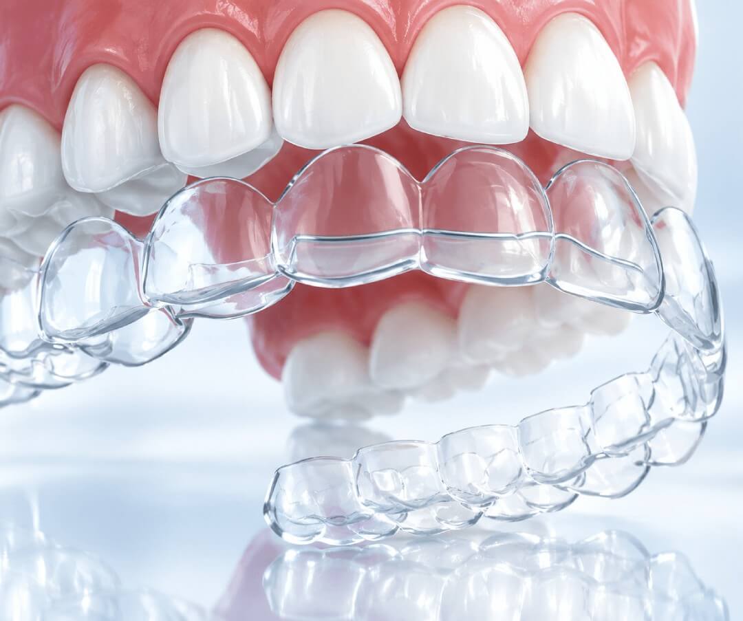 suresmile dental healthhub